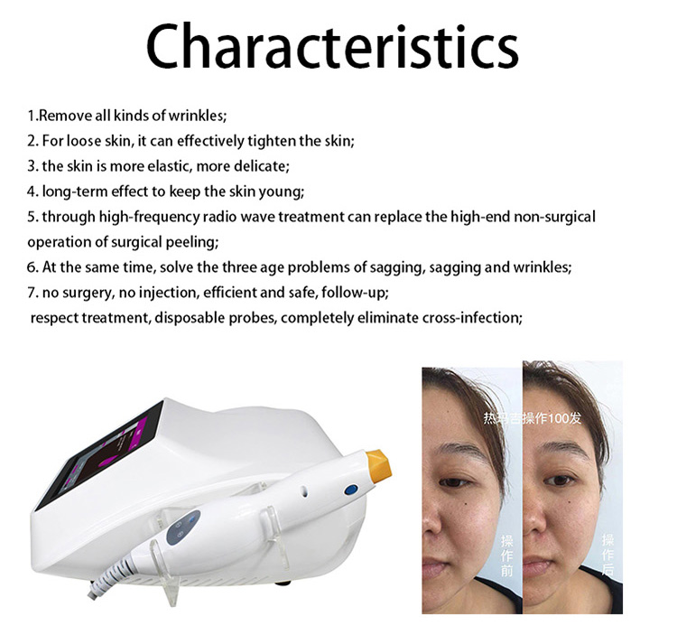 New Arrivals 2023 Portable Skin Tightening Rf Rf Machine Skin Lifting Skin Tightening Device For Face Lifting