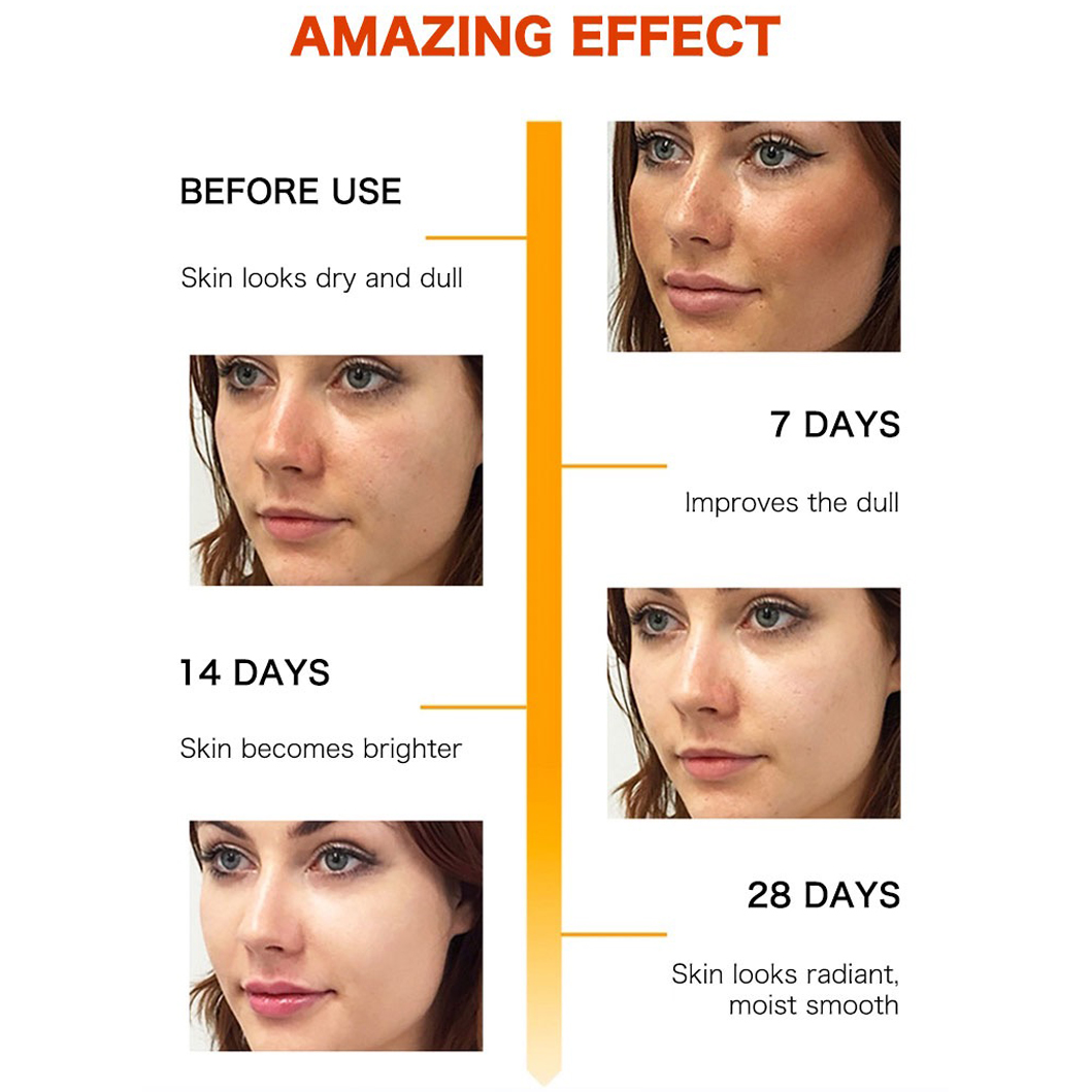 ELLEN ELLA Whitening Gold Vitamin C Face Serum 30ml 