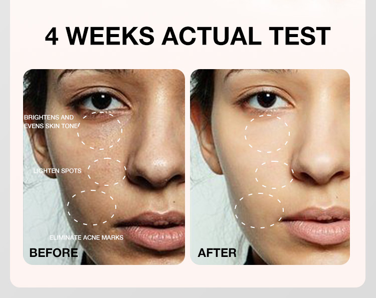 High-end skin care--serum skin care