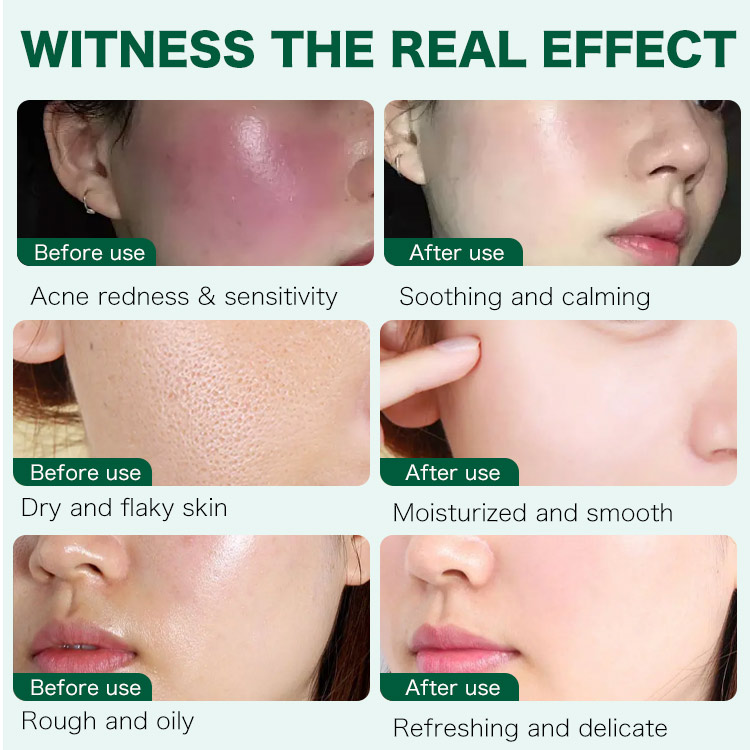 Ellen Ella Patented Centella Asiatica Skin Barrier Repair Cream