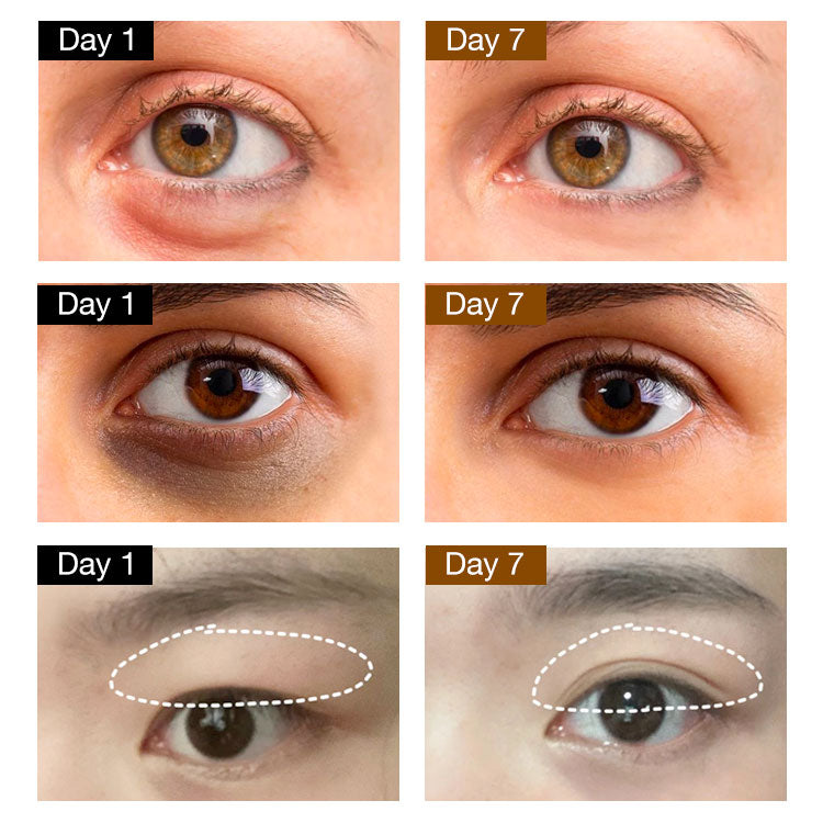 Silver Iron -Deep Sea Caviar Firming Eye Cream