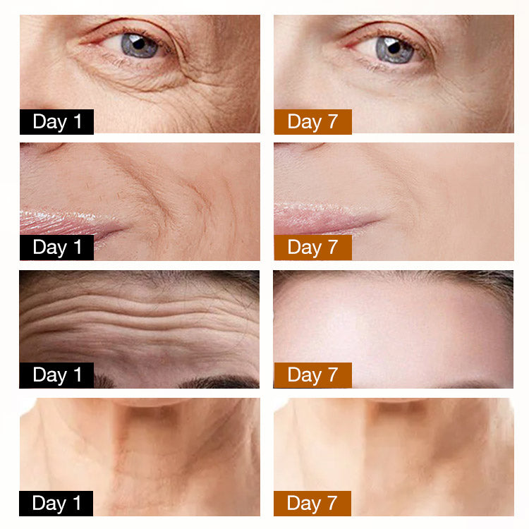 Golden Iron -retionl anti wrinkles Collagen Eye Cream