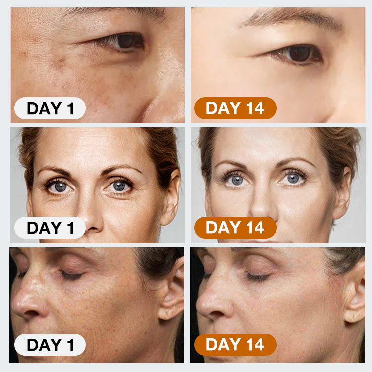 Upgrade Ellen Ella Retinol Face Cream-Effect Increased By 50%