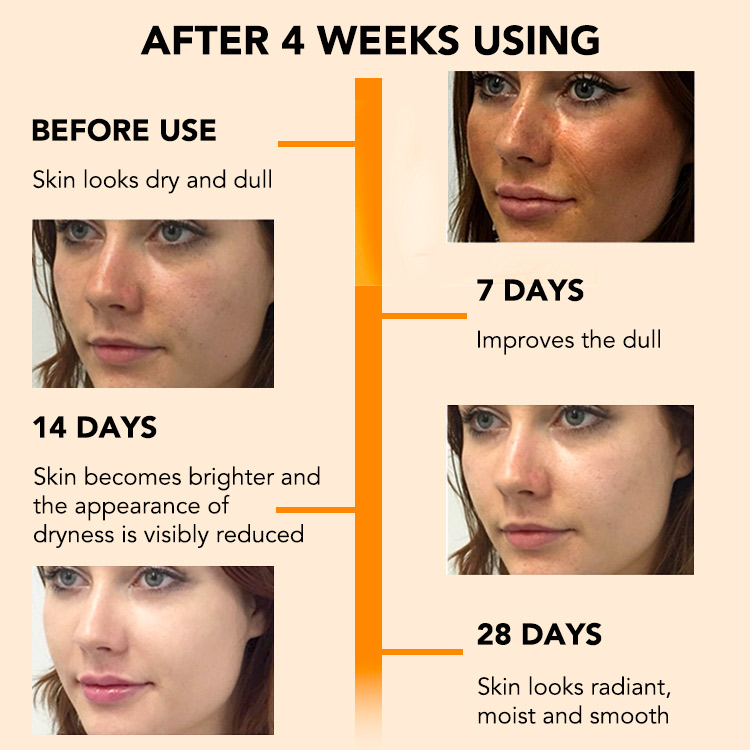 Age Personalized Upgrade morning C night A