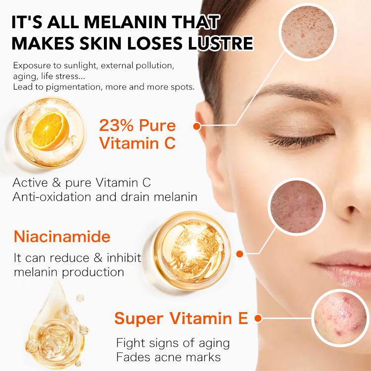 ELLEN ELLA Whitening Vitamin C Face Cream - Remove dark spot and brighten skin tone