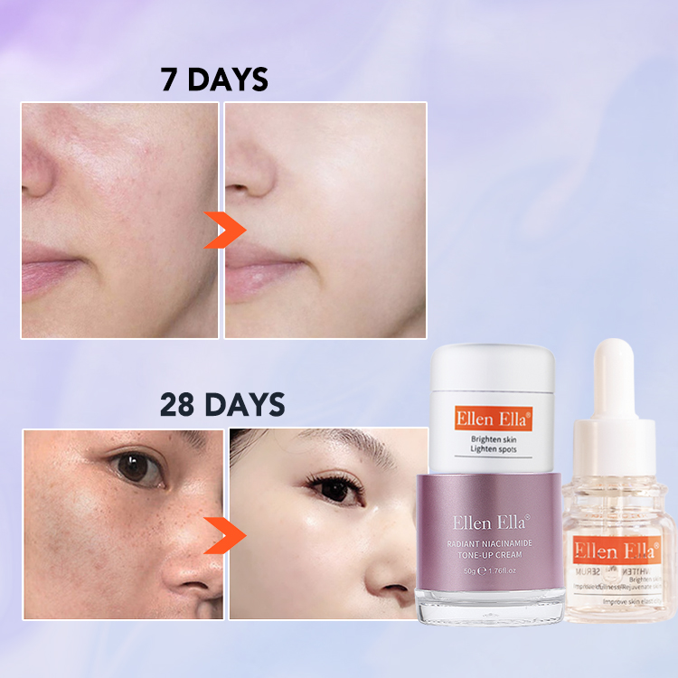 Upgrade Dark spot corrector combo