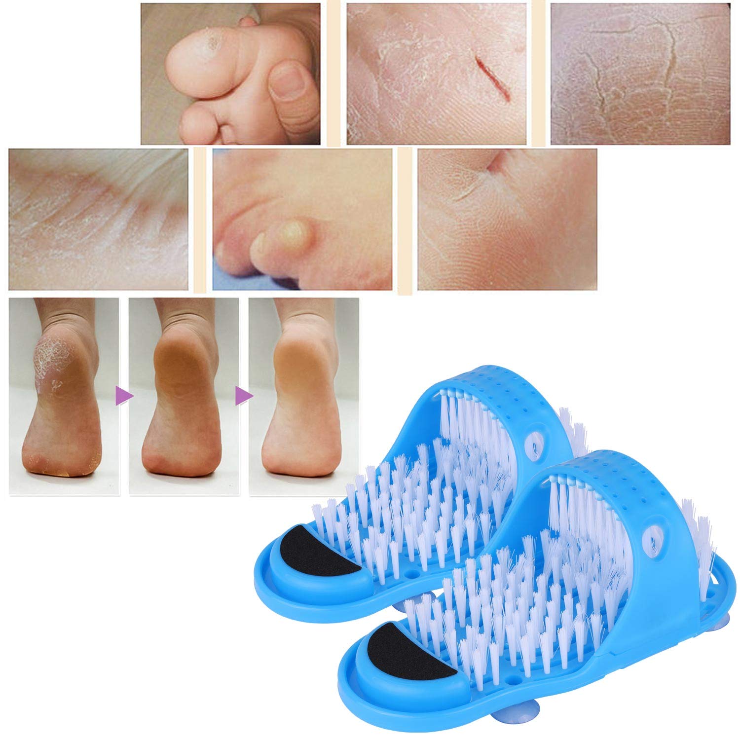 (🎅HOT SALE NOW-49% OFF)Shower Foot Scrubbing Massage Slippers