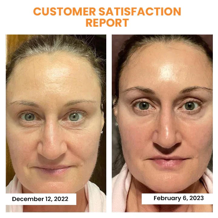 Korean Technology Soluble Collagen Film