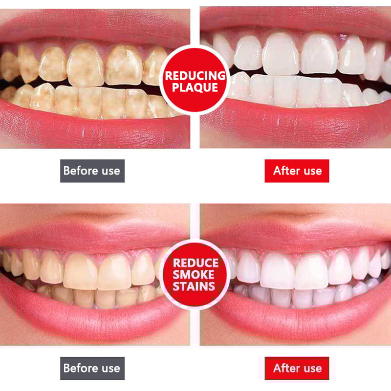 🔥2023 HOT SALE🔥 -  YAYASHI SP-4TM Probiotic Whitening Toothpaste