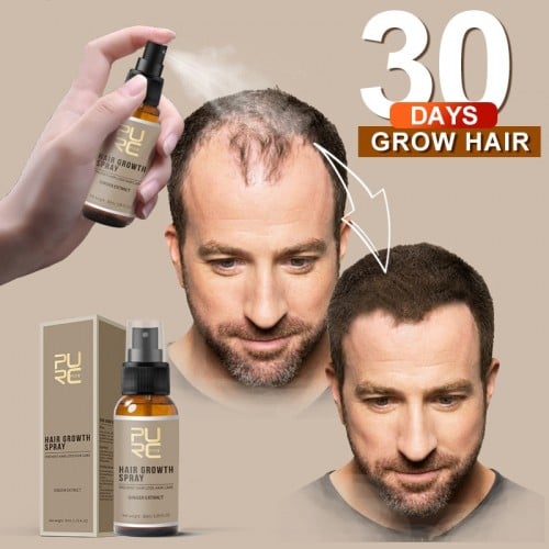 💥2023 New Hair Growth Spray - Fast Hair Growth - Prevent Hair Loss[🔥Buy 1 Get 1 Free🔥]