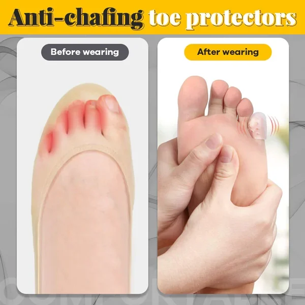 (🔥SUMMER HOT SALE- 49% OFF🔥) Silicone anti-friction toe protector