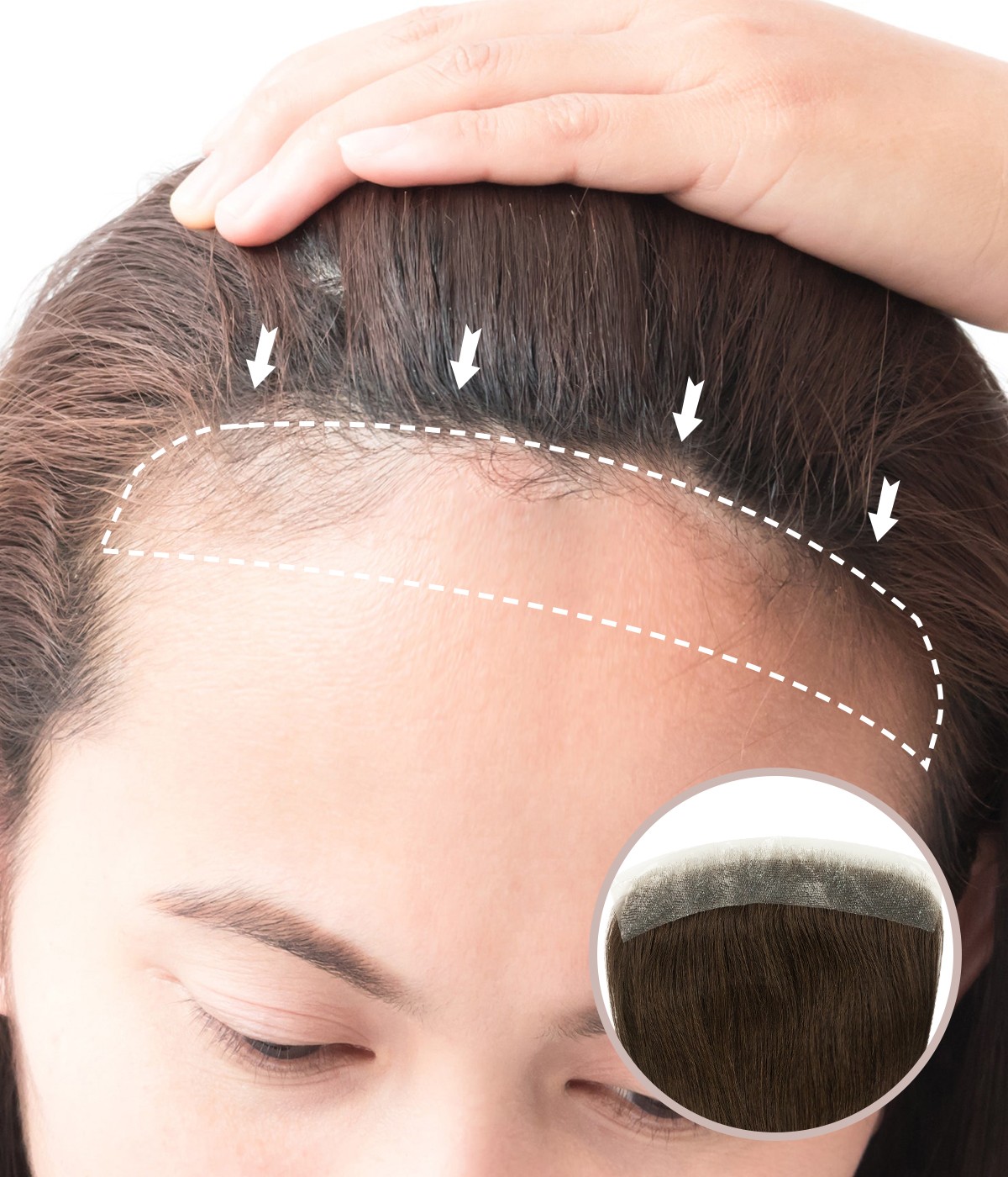 0.75"* 6.25"Full Skin Hand-Tied Front Hairline Cover-Up Human Hair Patches |No Surgical Solution For Receding Hairline