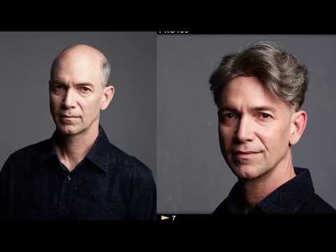 Men Hair Systems Before and After