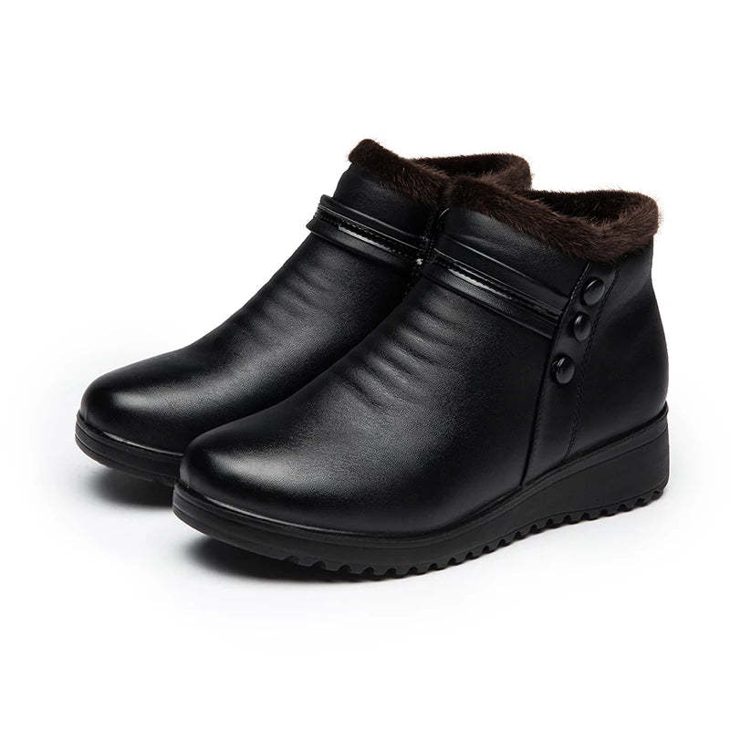 Orthopedic Snow Boots Women Leather Ankle Shoes