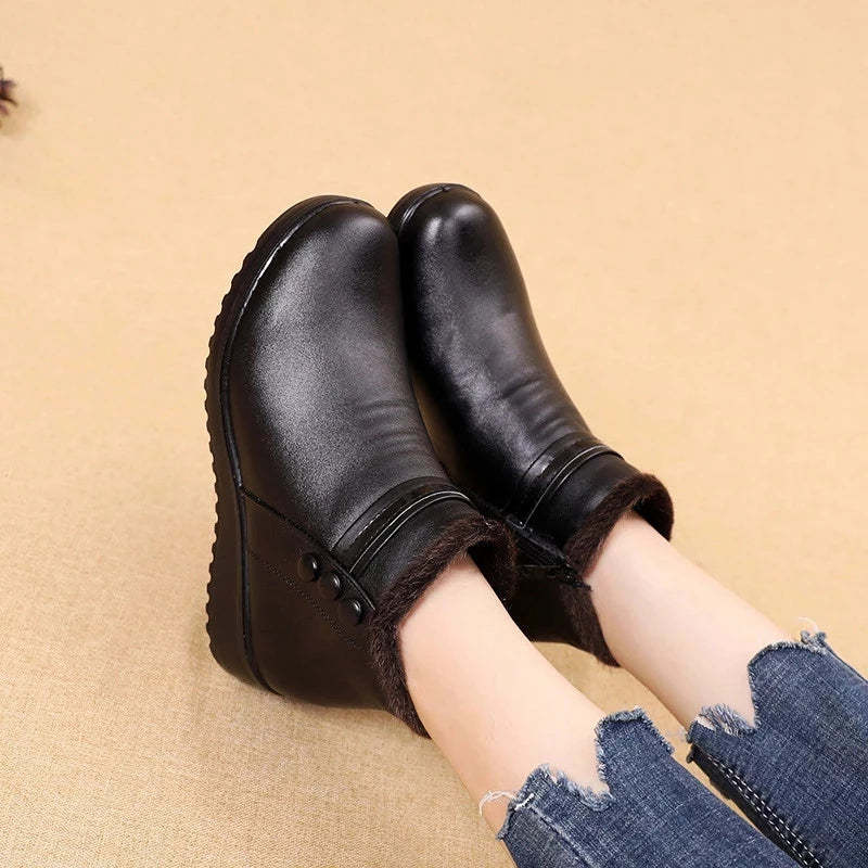 Orthopedic Snow Boots Women Leather Ankle Shoes