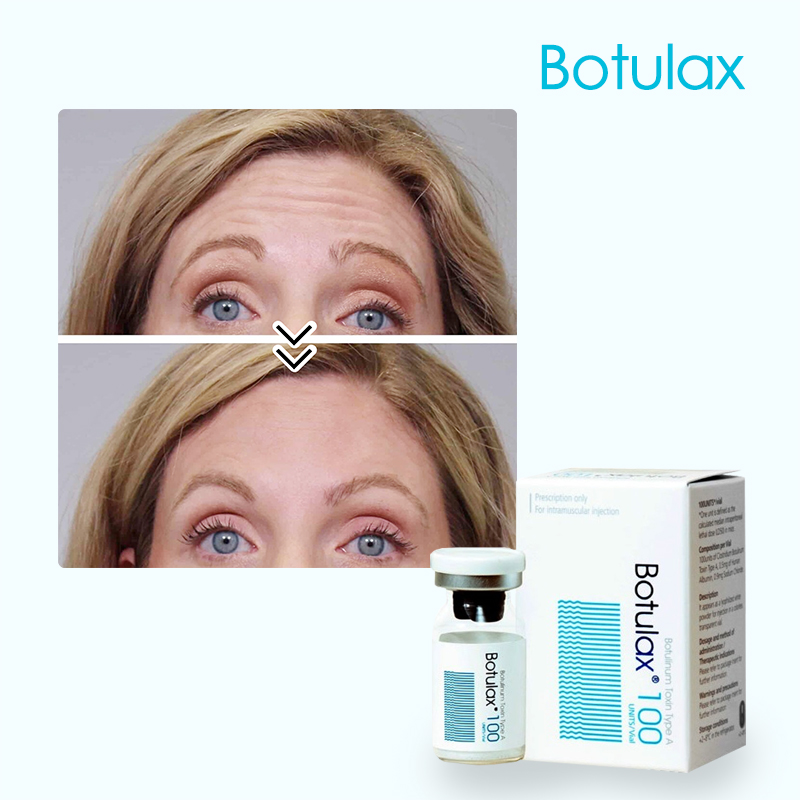 Can Nurses Buy Botulinum Toxin