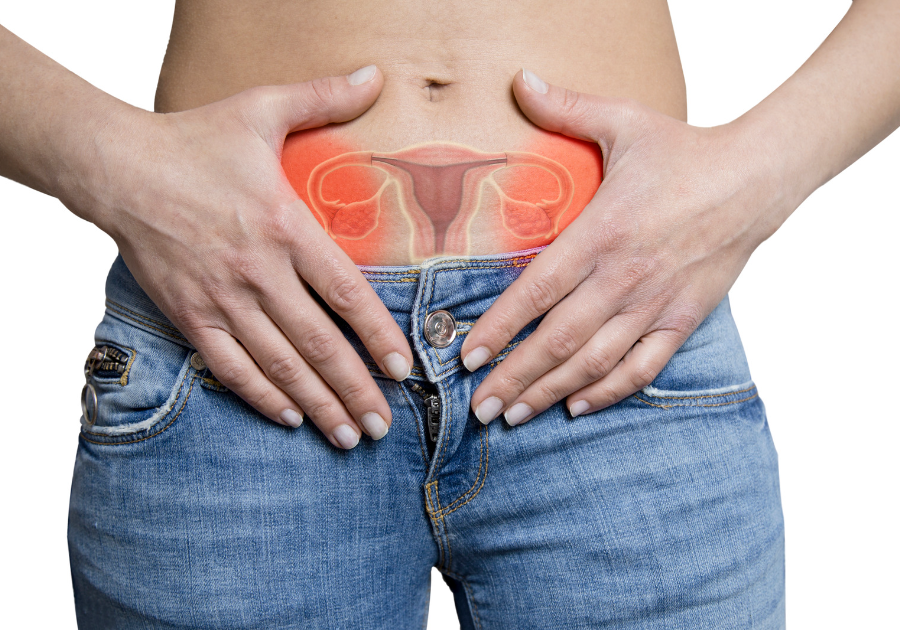 Polycystic Ovary Syndrome (PCOS) and Gut-Mind Connection